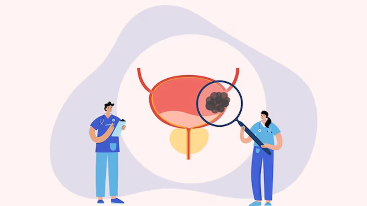 Symptoms of Bladder Cancer You Shouldn’t Ignore